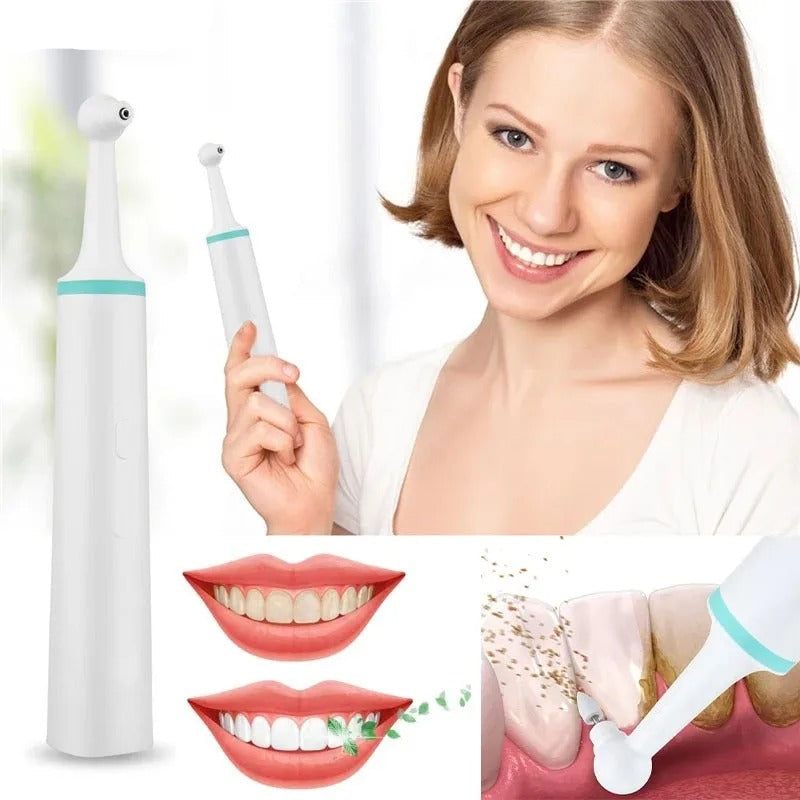 Electric Dental Plaque Remover Oral Hygiene Device - BritishMode